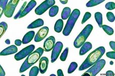 151119104918_clostridium_difficile_drug-resistant_bacteria_coloured_transmission_electron_micrograph_640x360_sciencephotolibrary.jpg